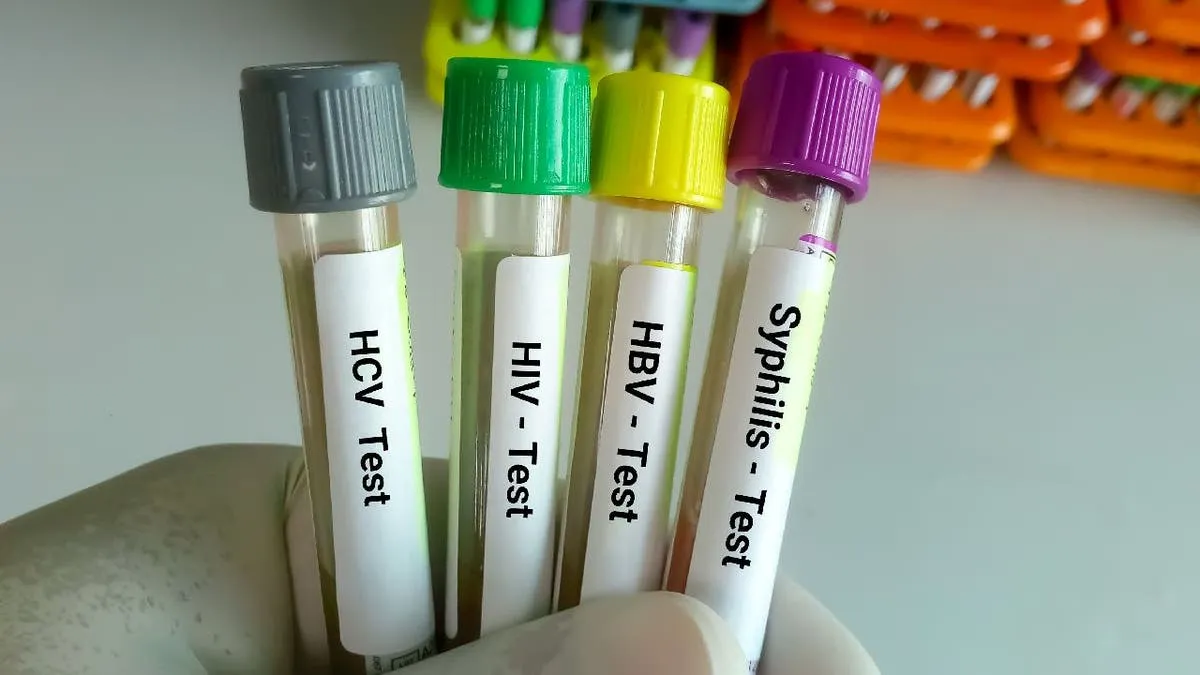 Four STD test samples